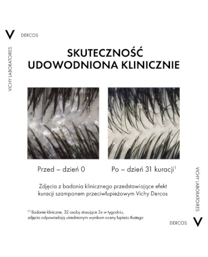 Vichy Dercos szampon przeciwłupieżowy do włosów suchych 390 ml