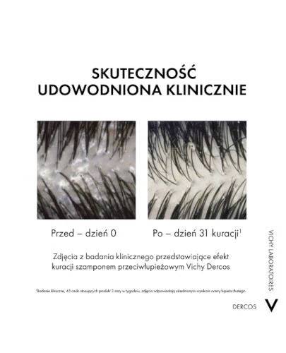 Vichy Dercos DS Szampon przeciwłupieżowy z odżywką 2w1 200 ml